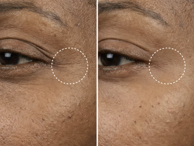 AloeVera Icy-Awake | Hydraterende oog patches