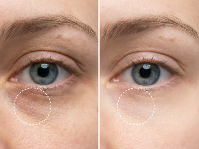 AloeVera Icy-Awake | Hydraterende oog patches